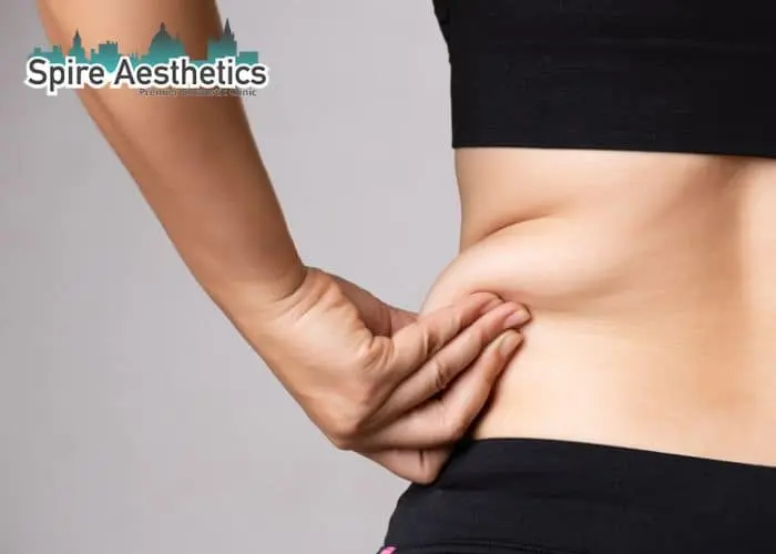 Image of woman pinching fat on their hips Cirencester. Fat Freezing treatment