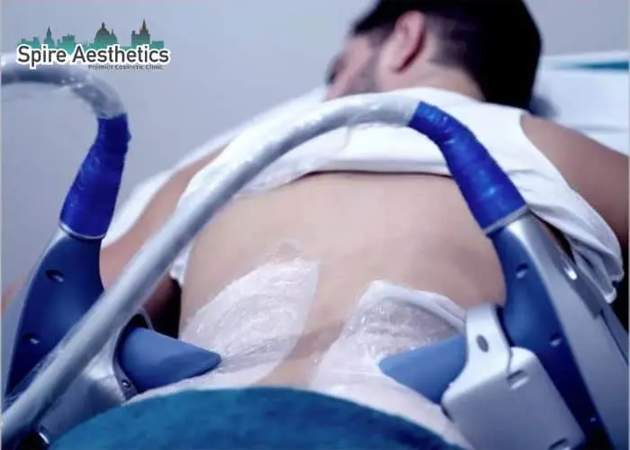 Man having fat freezing treatment done on love handles before a competitions Cirencester to create a sculpted look.