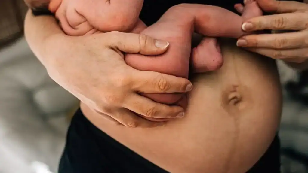 Why Is My Stomach Still Big After Pregnancy Cirencester?