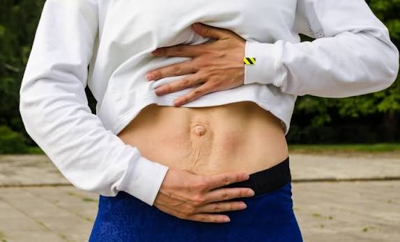 When Could Diastasis Recti Be the Missing Piece of the Puzzle Cirencester?